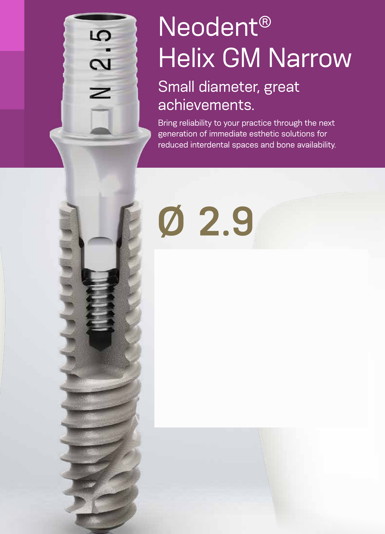 Neodent Helix GM Narrow — Ø 2.9mm. Small diameter, great achievements.